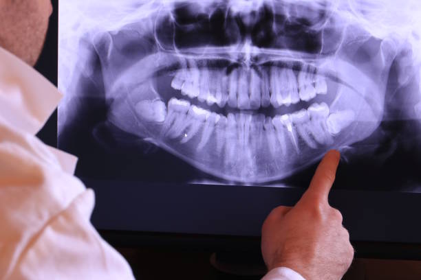 Best Emergency Denture Repair in Hercules, CA
