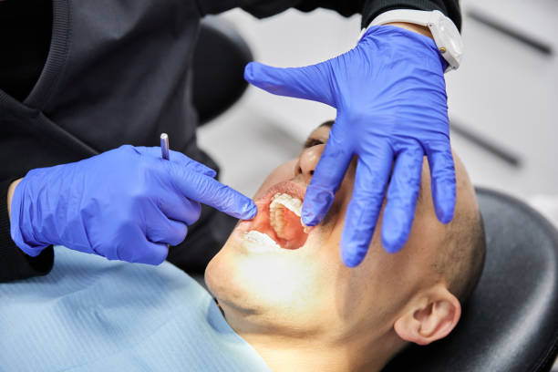 Best Emergency Tooth Extraction in Hercules, CA